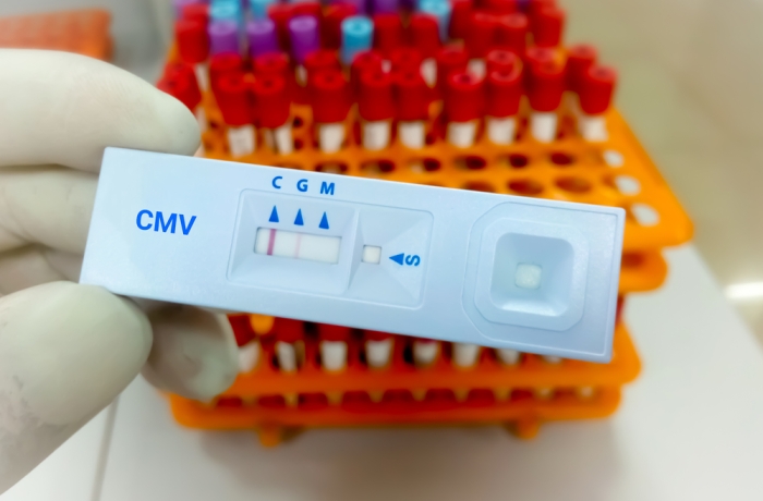 Close view of technician or technologist hand hold a device of Cytomegalovirus (CMV) rapid screening test
