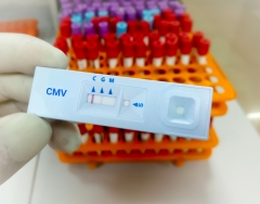 Close view of technician or technologist hand hold a device of Cytomegalovirus (CMV) rapid screening test